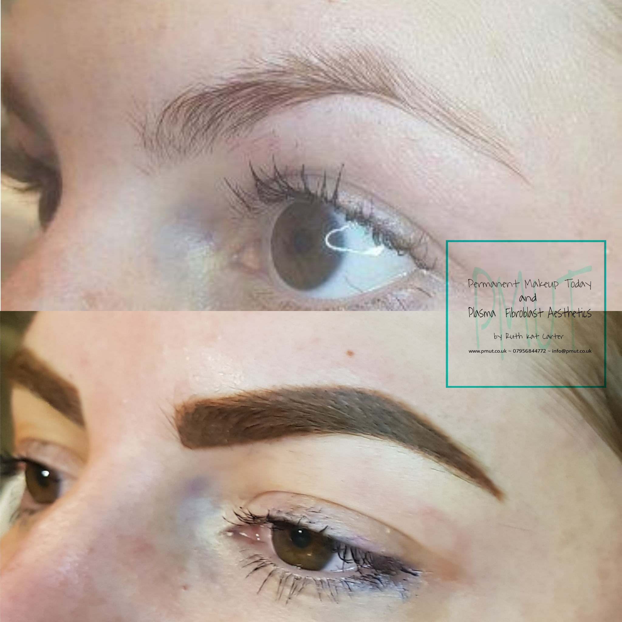 Brows Procedure