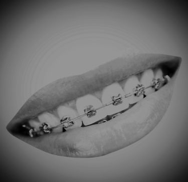 Diagram of the temporomandibular joint showing root-cause issues of jaw locking and clicking