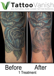 Roses 1 Treatment.jpeg