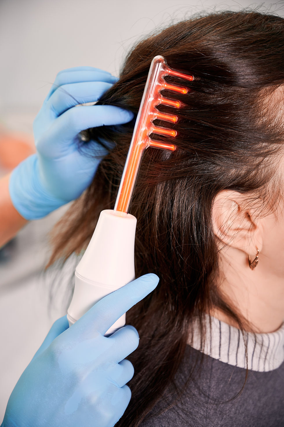 Tricologista penteando cabelo de mulher com uma escova de laser para tratamento capilar