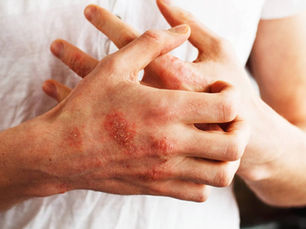 Understanding Autoimmune Diseases (Made Simple!)