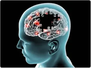 Alzheimer's Disease Impacts on the Brain
