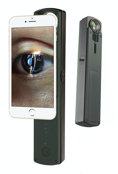 Portable Slit Lamp