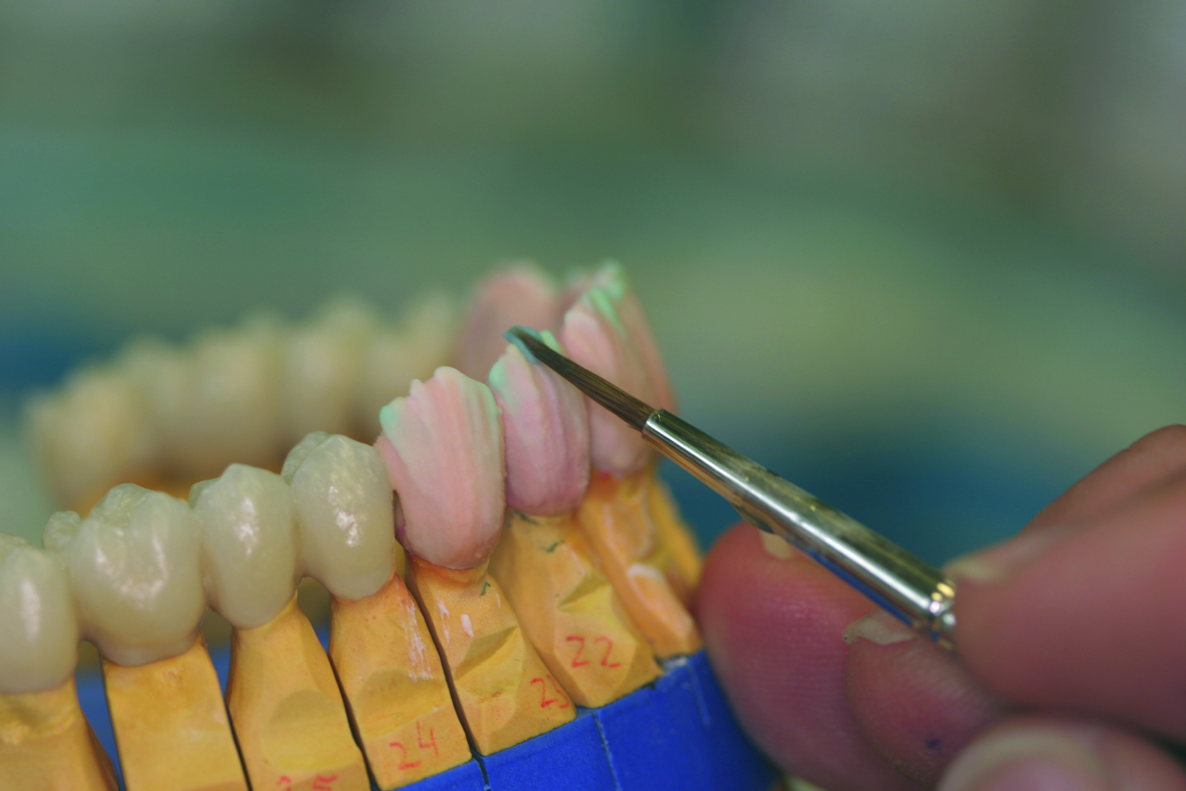 ZAHNTECHNIK dentaltraub