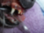 Case #5: Bone Loss