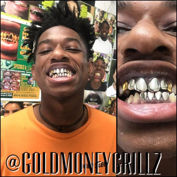 Gold Money Grillz
