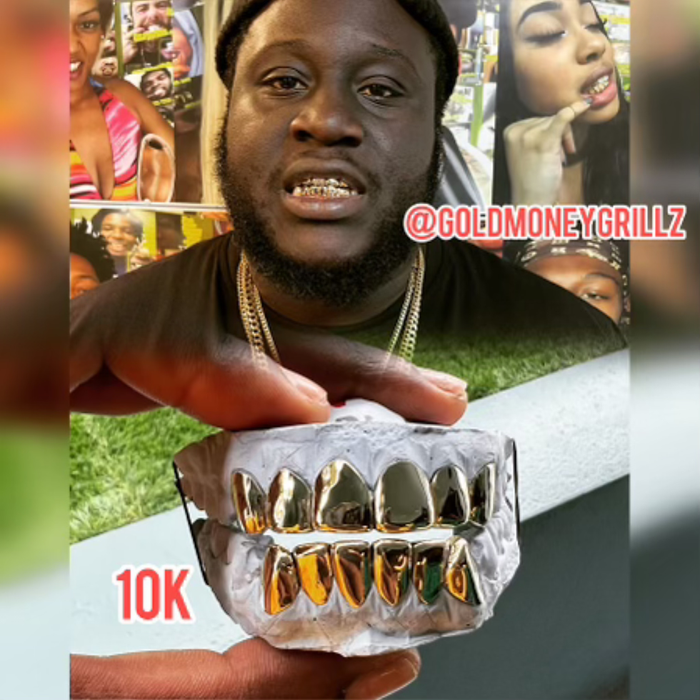 10K Top to Bottom Gold Grillz goldmoney