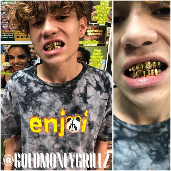 Gold Money Grillz