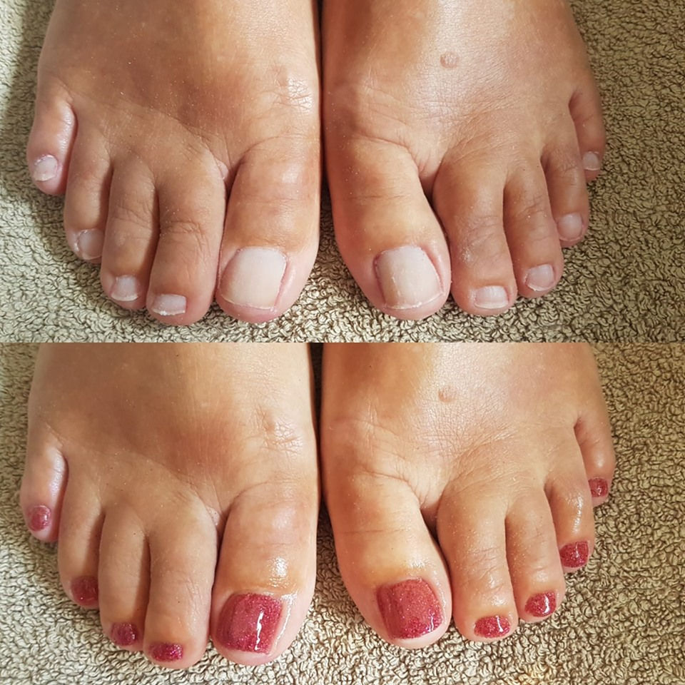 Pedi
