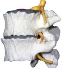 Chiropractic helps degeneration