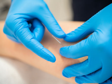 Manual Therapy for Podiatry Patients: A Comprehensive Approach to Foot Care