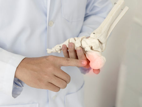 Does heel pain stop you from your activities?