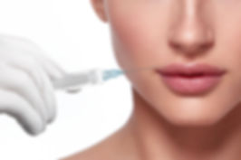 Dermal fillers for the treatment of: Lips, cheeks, nose, chine, jaw, nasolabial folds, marionette lines and unde eye area