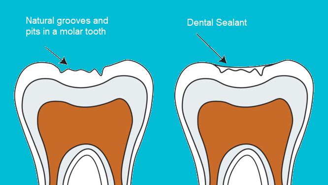 2025’s Hottest Dental Trends Revealed by Dr. Kevin Molldrem: From AI Tooth Scans to Same-Day Smile Makeovers