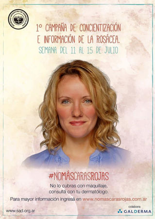 CAMPAÑA ROSÁCEA