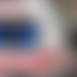 NGJARJE E RËNDË/ DETAJE nga vd*kja e 4-vjeçarit. Dyshohet se i bëri reaksion mjalti