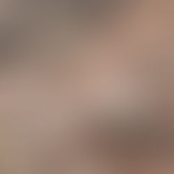 Bie masivi shkëmbor në aksin Librazhd-Prrenjas, bllokohet totalisht qarkullimi