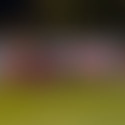 Skënderbeu përballet me mungesa kyçe, ja reparti që ka mungesat