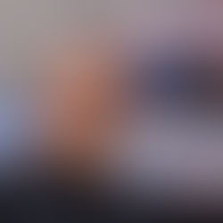 Publikohet fotoja, ky është mjeku që u sulmua me shkop bejsbolli nga tre persona të maskuar