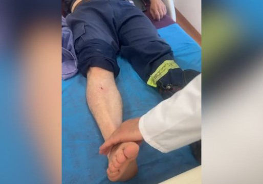 Përballë flakëve dhe gurëve të malit, zjarrfikësi pl*goset gjatë operacionit