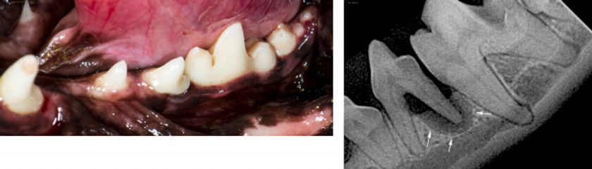 Bone_loss_xray_normal_tooth_photo-01.jpg