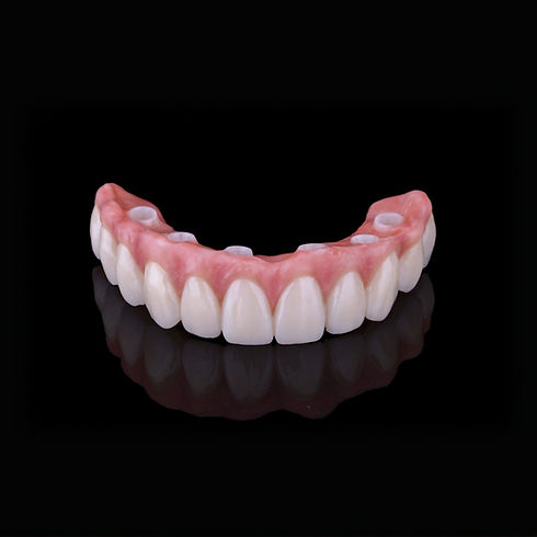 All-on-6+Zirconia+Implant+Bridge_edited.jpg