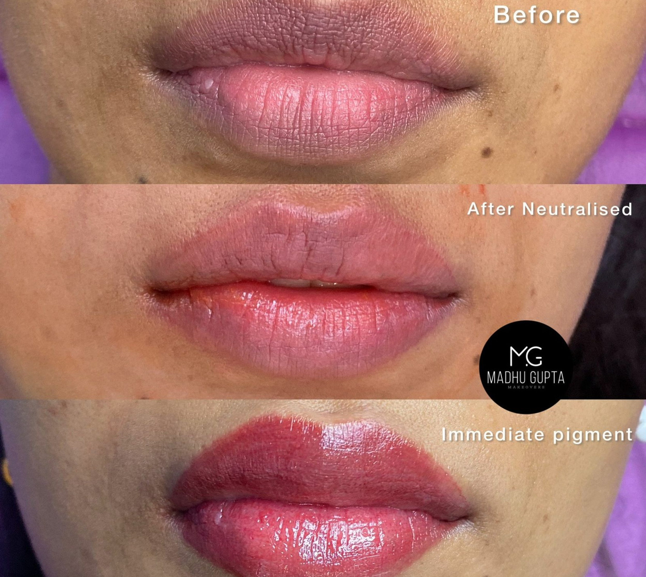 PERMANENT LIP TINT By Madhu Gupta Makeovers permanent-lip-tint-by-madhu-gupta-makeovers