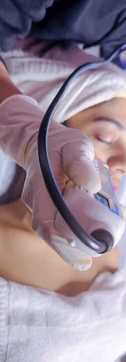 Hydra Facial in Gurgaon by MG Makeovers