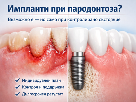Импланти при пародонтоза: какво трябва да знаете преди лечение?
