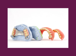 FMR Dentures