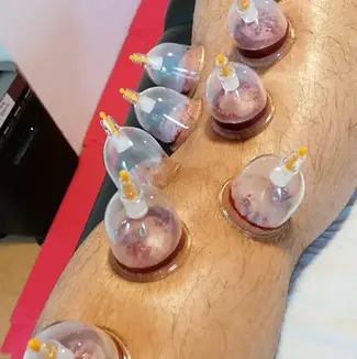 Cupping therapy, gua sha, gua sha massage, gua sha massage therapy, gua sha massage London, gua sha massage near me, gua sha near me, gua sha cupping therapy, gua sha head massage, gua sha back massage, gua sha body massage, gua sha massage therapy near me, gua sha back massage near me, gua sha treatment London, hijama cupping therapy near me, hijama therapy, hijama therapy near me, hijama therapy London, hijama therapy UK, hijama wet cupping therapy near me, massage cupping therapy, massage therapy services, acupuncture services, acupuncture, acupuncture London, acupuncture treatment London, acupuncture therapist near me, acupuncture massage, acupuncture and massage near me, acupuncture therapy, acupuncture treatment in London, acupuncture north London, acupuncture in London, acupuncture service, acupuncture in north London, acupuncture treatments, acupuncture west London, acupuncture and massage therapy, physio acupuncture near me, best acupuncture near me, graston therapy. 