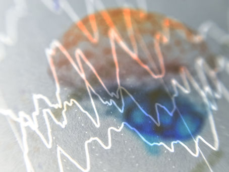 Epilepsia em destaque 