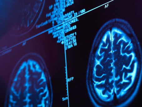 Delírio e psicose: cientistas alertam para distúrbios cerebrais em casos de covid-19