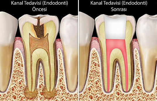 marmaris dental clinic