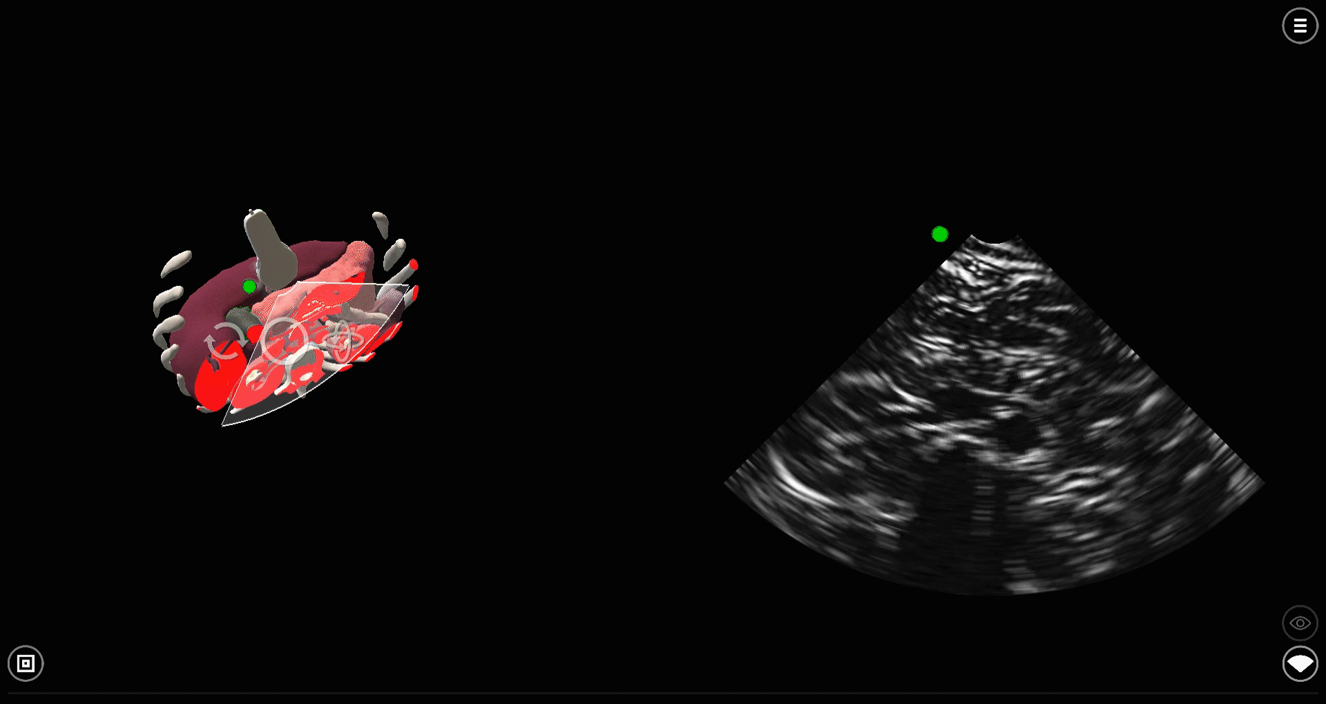 deepscope_movement_gif.gif