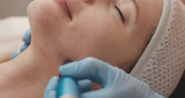 Microneedling: What to Expect Before, During, and After