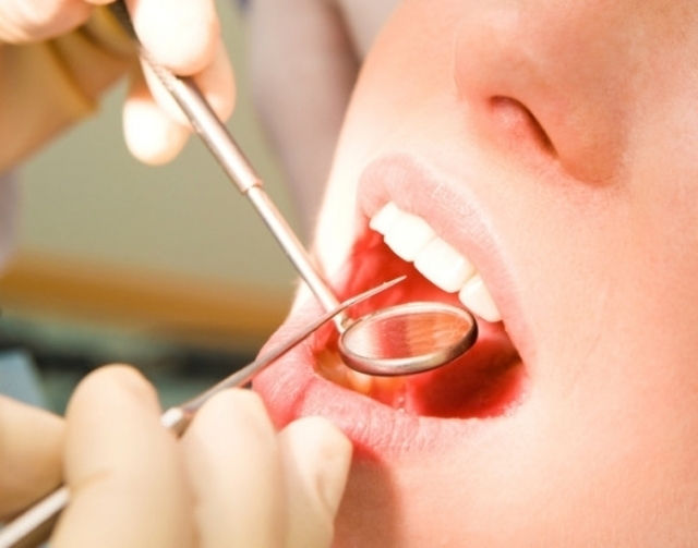 Dentist Mouth