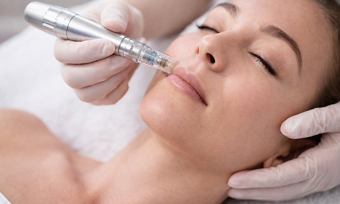 microneedling.png