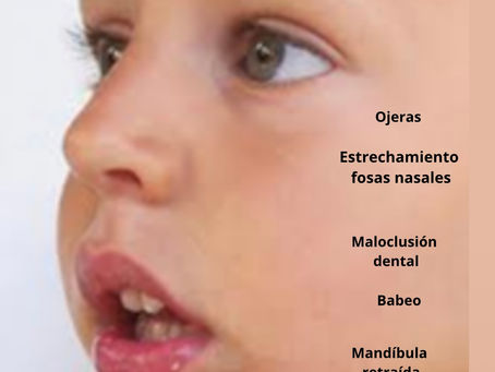 Respiración bucal en los niños