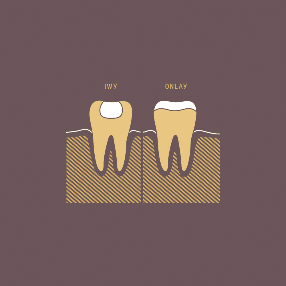 illustrations-dents.gif