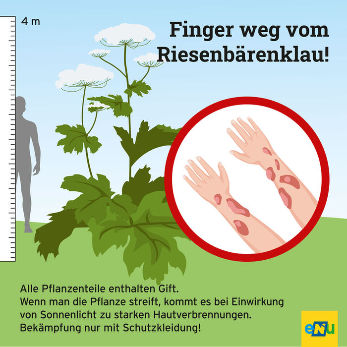 Infografik zum Riesenbärenklau warnt vor Hautverbrennungen.