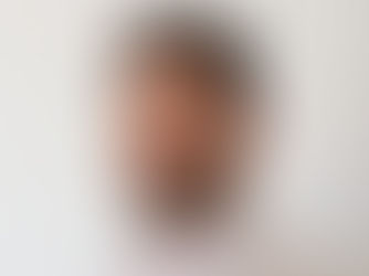 Dia Nacional do Combate ao Glaucoma: doença que afeta 2,5 milhões de brasileiros pode causar perda de visão irreversível