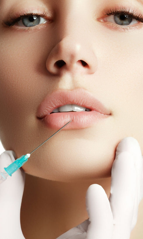 Frau wird die Lippenaufspritzen Unterspritzung mit Hyaluronsäure und Filler bei perfect esthetics in Zürich für die schönsten Lippen Wangen Kinn Jawline