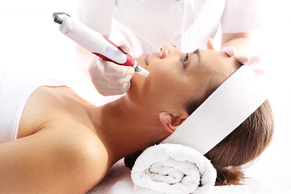 Microneedling.jpeg
