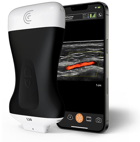 Clarius Aesthetics Ultrasound.jpg