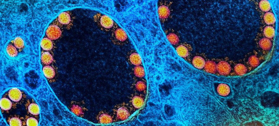 SP confirma primeiro caso de morte relacionado à subvariante BQ.1 da Covid-19