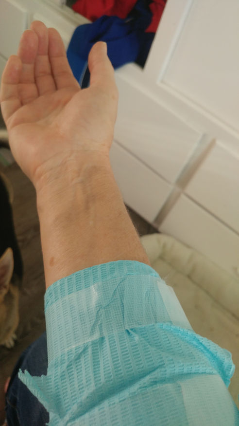 The rise of the Phoenix