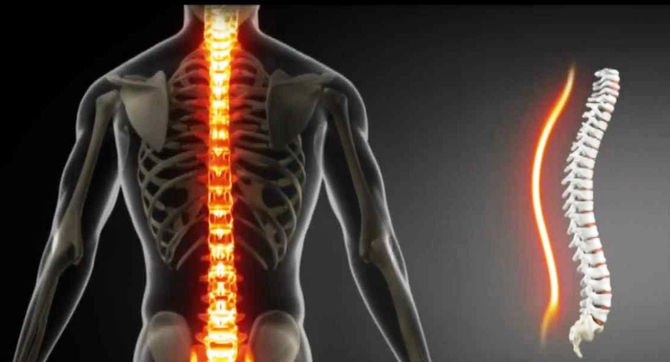 Coluna Vertebral
