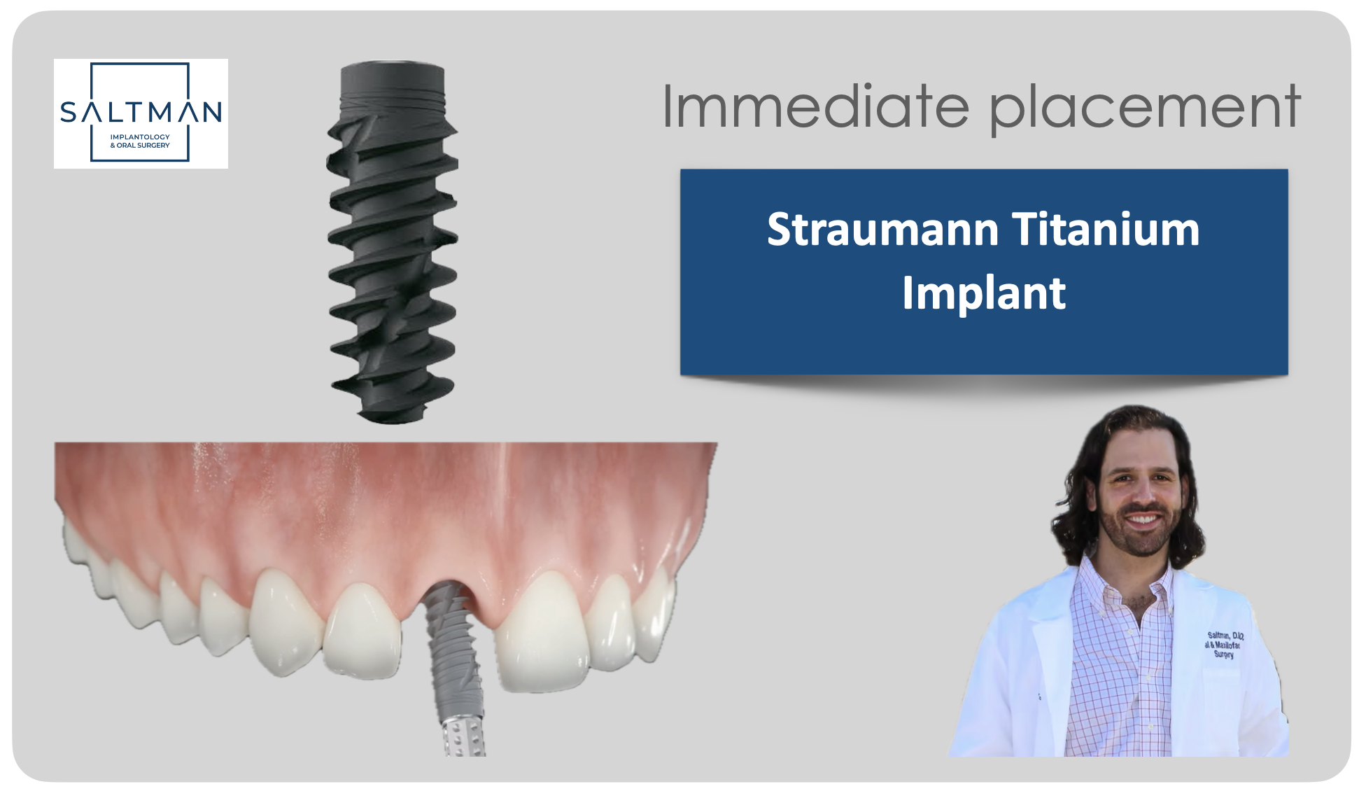 Immediate Dental Implants in Washington DC | Saltman Oral Surgery