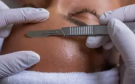 dermaplaning.webp
